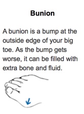 Bunion